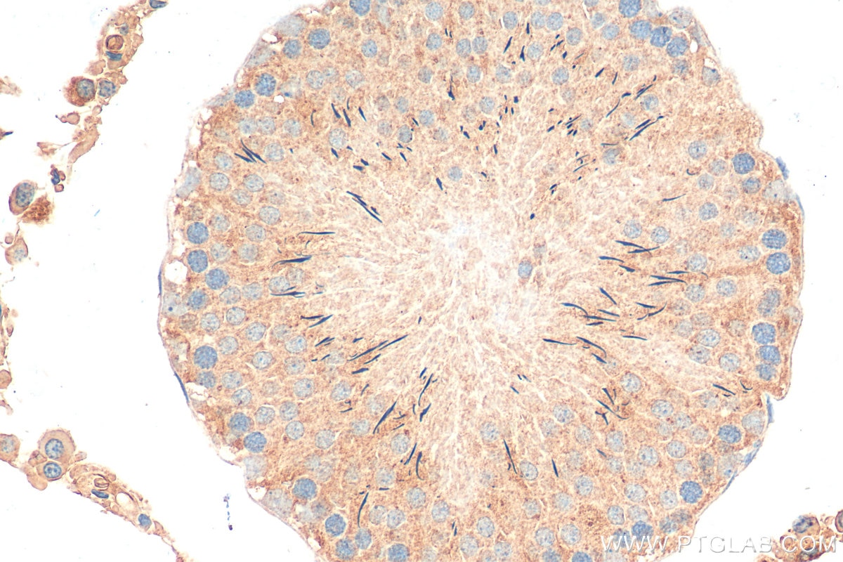 Immunohistochemistry (IHC) staining of rat testis tissue using SFRP4 Polyclonal antibody (15328-1-AP)