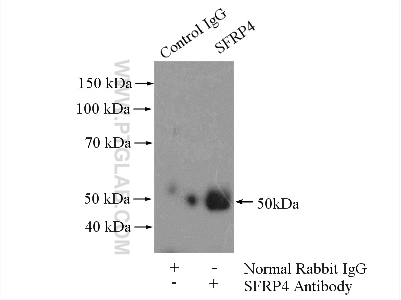 Immunoprecipitation (IP) experiment of HeLa cells using SFRP4 Polyclonal antibody (15328-1-AP)