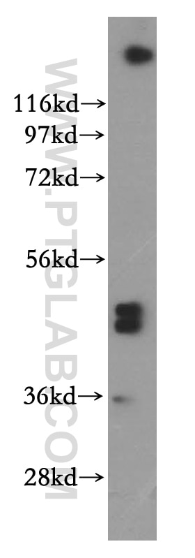 Western Blot (WB) analysis of HeLa cells using SFRP4 Polyclonal antibody (15328-1-AP)