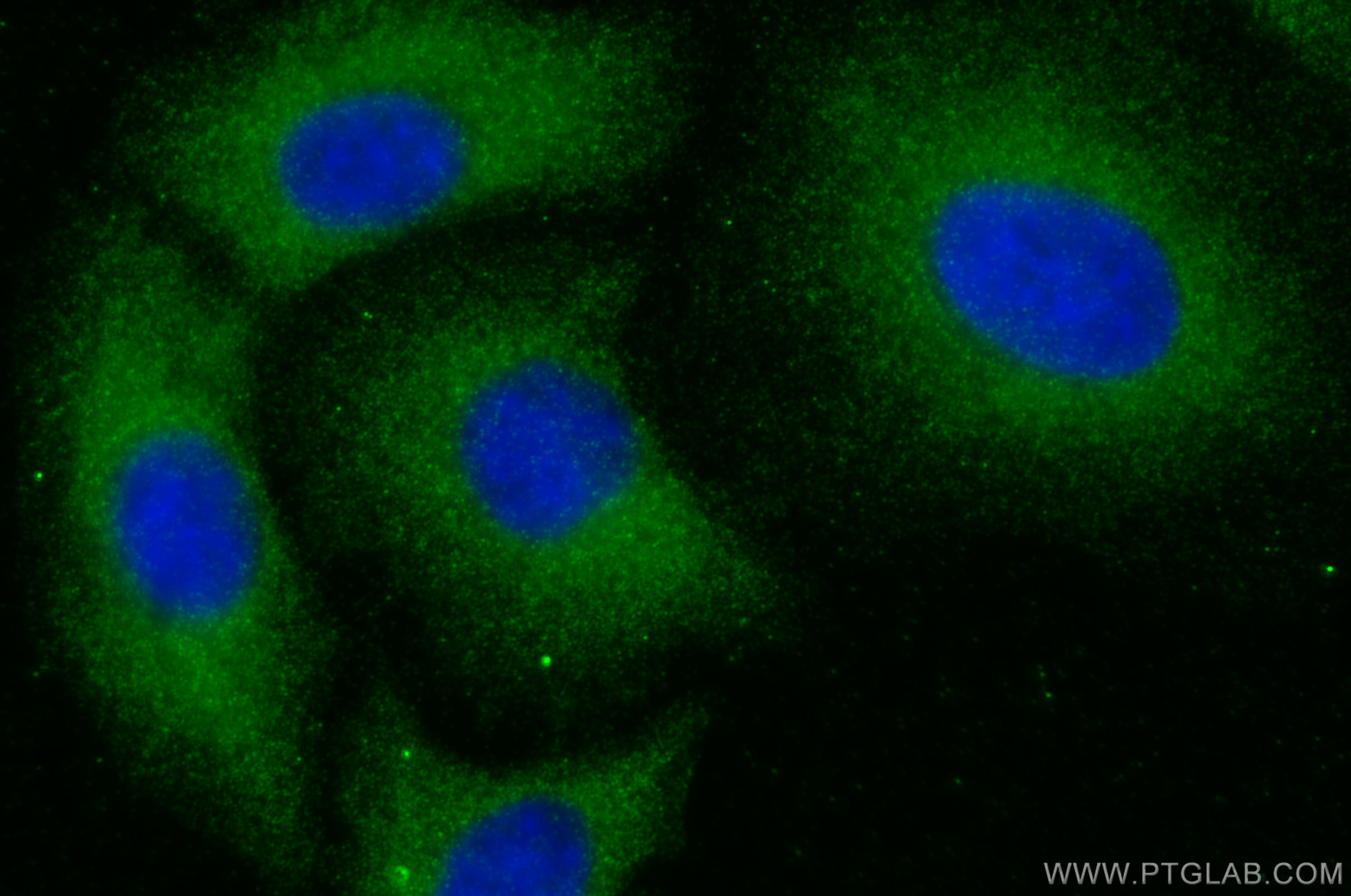 Immunofluorescence (IF) / fluorescent staining of A549 cells using SFRP5 Polyclonal antibody (14283-1-AP)