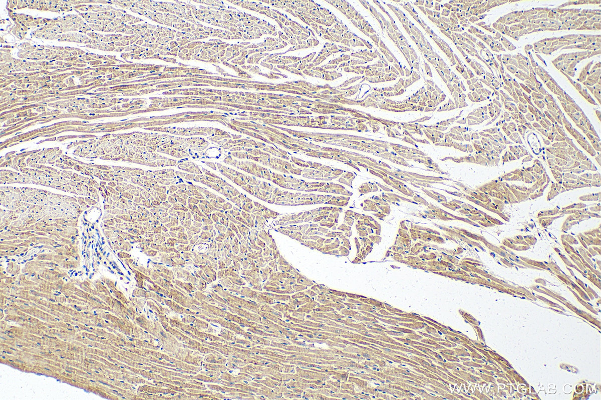 Immunohistochemistry (IHC) staining of mouse heart tissue using SFRP5 Polyclonal antibody (14283-1-AP)