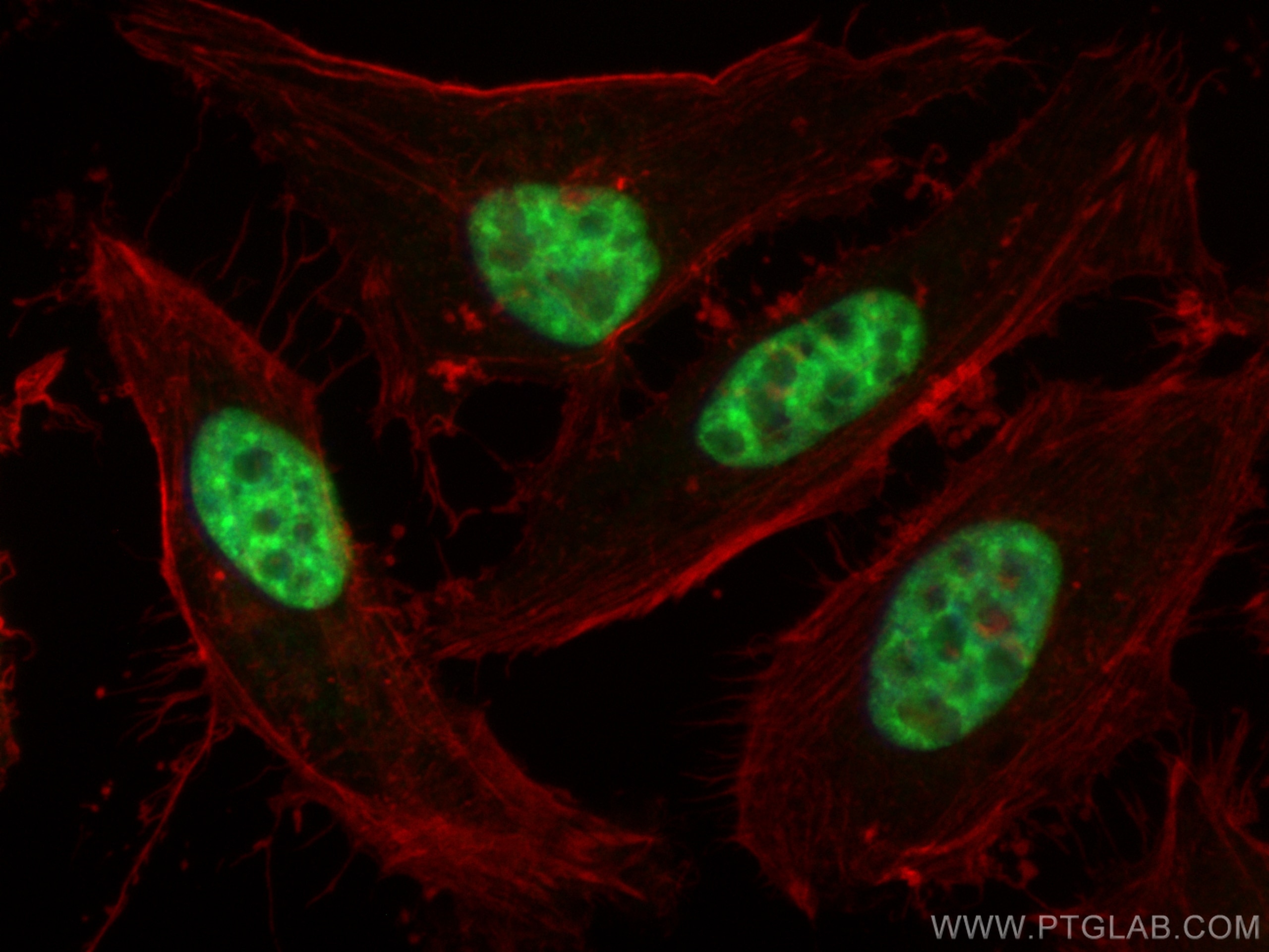 Immunofluorescence (IF) / fluorescent staining of HeLa cells using ASF/SF2 Polyclonal antibody (12929-2-AP)