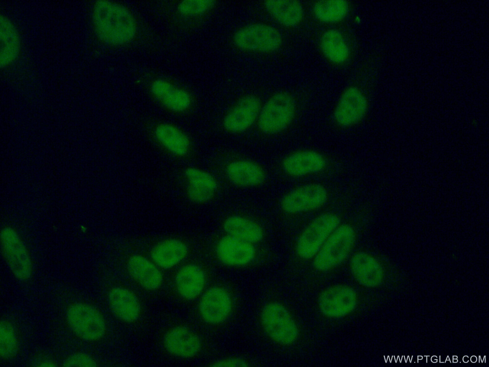 Immunofluorescence (IF) / fluorescent staining of HeLa cells using ASF/SF2 Polyclonal antibody (12929-2-AP)
