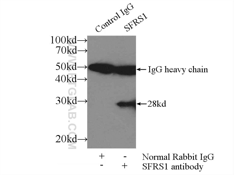 Immunoprecipitation (IP) experiment of mouse brain tissue using ASF/SF2 Polyclonal antibody (12929-2-AP)
