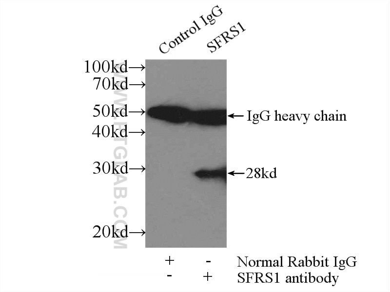 IP experiment of mouse brain using 12929-2-AP