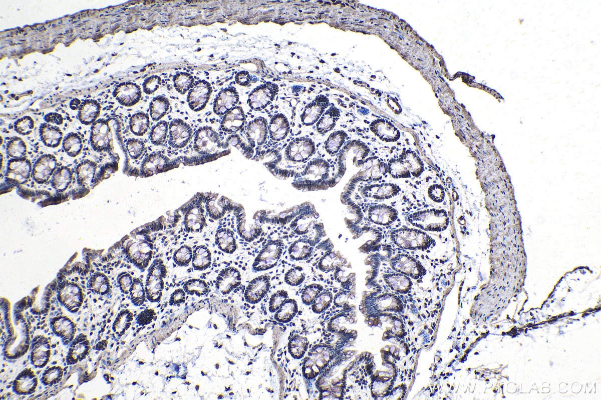 Immunohistochemistry (IHC) staining of rat colon tissue using SFRS11 Polyclonal antibody (26751-1-AP)