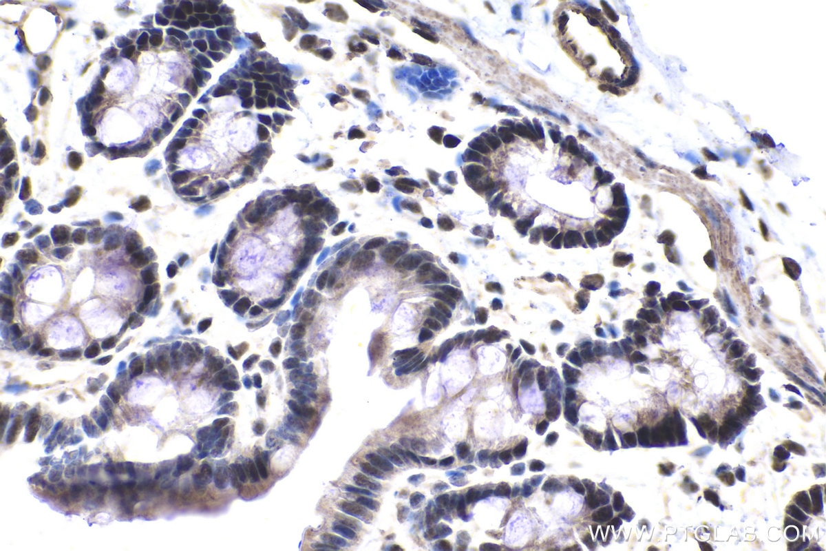 Immunohistochemistry (IHC) staining of rat colon tissue using SFRS11 Polyclonal antibody (26751-1-AP)