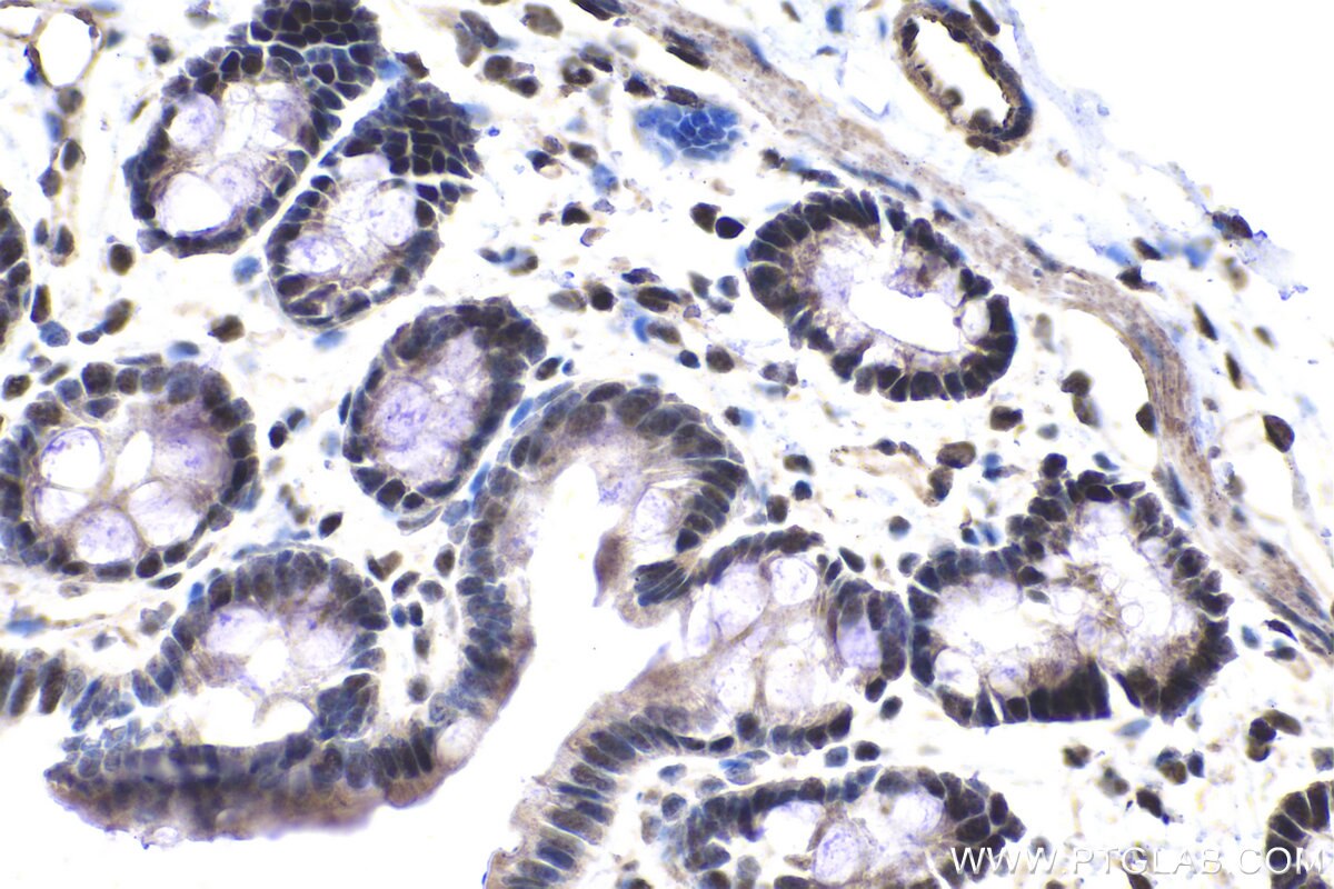 IHC staining of rat colon using 26751-1-AP