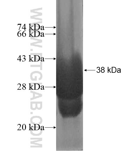 SFRS12IP1 fusion protein Ag12324 SDS-PAGE