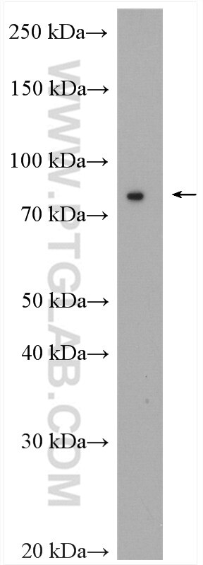 Western Blot (WB) analysis of Jurkat cells using SFRS17A Polyclonal antibody (13441-1-AP)