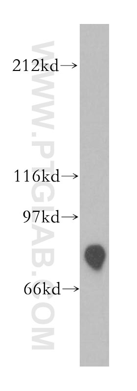 Western Blot (WB) analysis of human kidney tissue using SFRS17A Polyclonal antibody (13441-1-AP)
