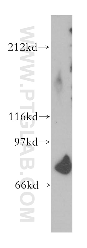 Western Blot (WB) analysis of human heart tissue using SFRS17A Polyclonal antibody (13441-1-AP)