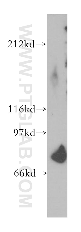 WB analysis of human heart using 13441-1-AP