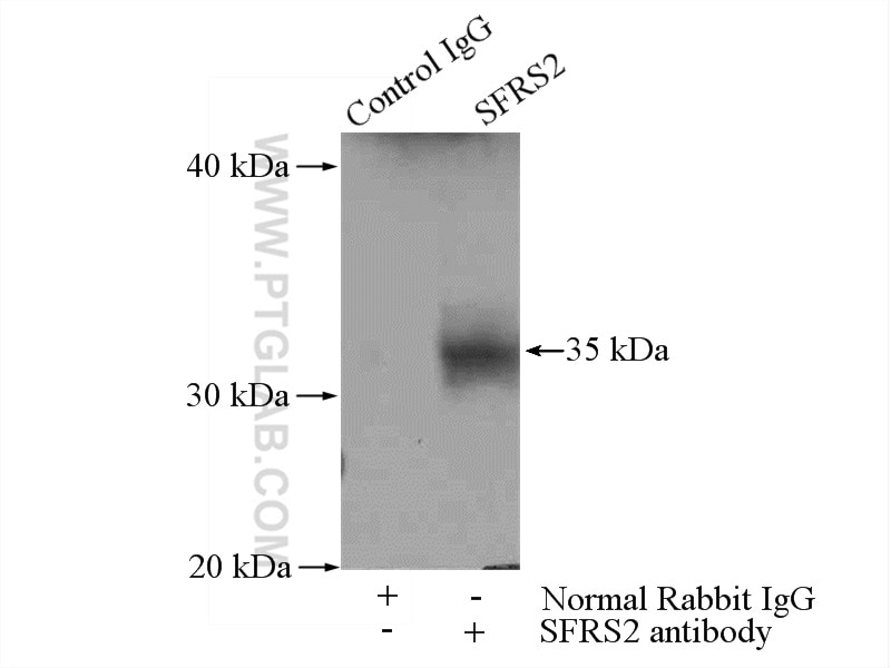 Immunoprecipitation (IP) experiment of mouse brain tissue using SFRS2 Polyclonal antibody (20371-1-AP)