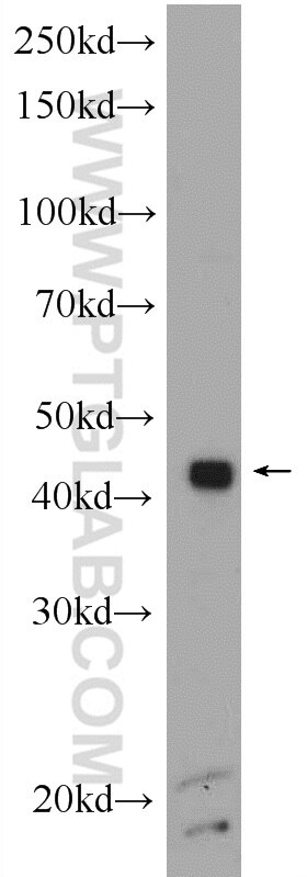 Western Blot (WB) analysis of rat brain tissue using SFRS2 Polyclonal antibody (20371-1-AP)