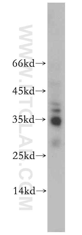 Western Blot (WB) analysis of mouse testis tissue using SFRS2 Polyclonal antibody (20371-1-AP)