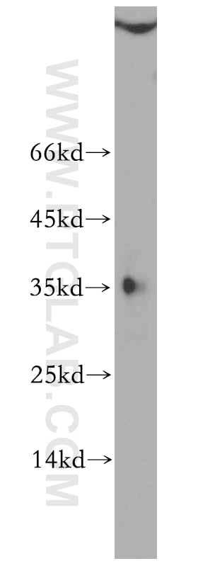 Western Blot (WB) analysis of A549 cells using SFRS2 Polyclonal antibody (20371-1-AP)