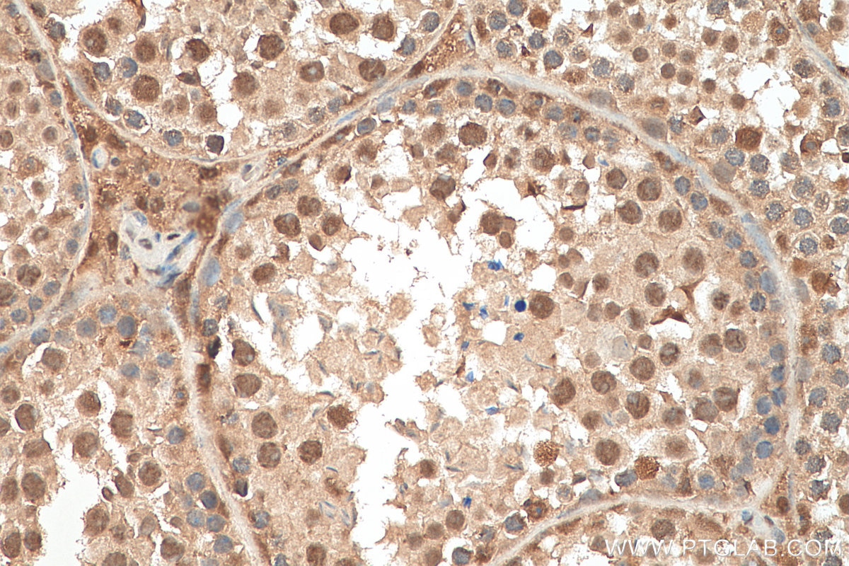 Immunohistochemistry (IHC) staining of mouse testis tissue using SRp20 Polyclonal antibody (10916-1-AP)
