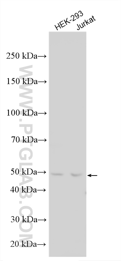 Various lysates were subjected to SDS PAGE followed by western blot with 33904-1-AP (SFRS4 antibody) at dilution of 1:2000 incubated at room temperature for 1.5 hours. Western Blot (WB) analysis of various lysates using SFRS4 Polyclonal antibody (33904-1-AP)