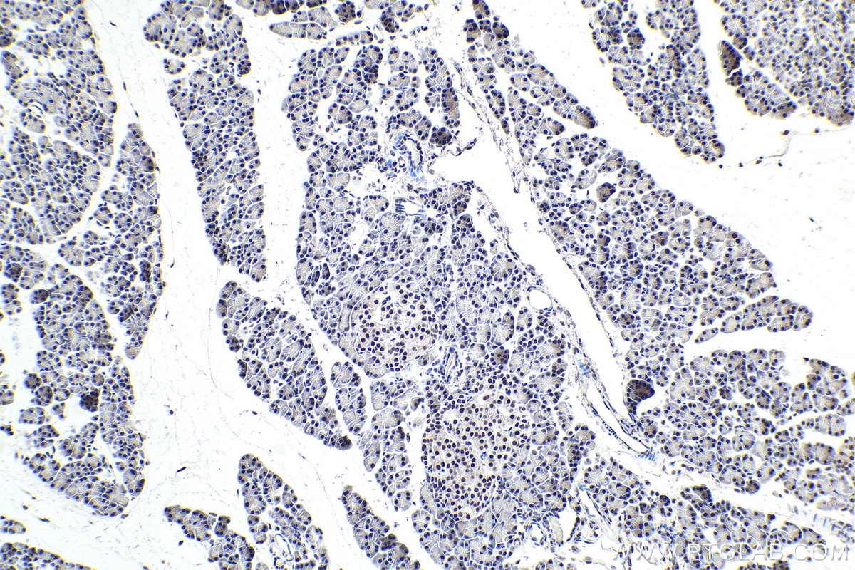 IHC staining of rat pancreas using 16237-1-AP Immunohistochemistry (IHC) staining of rat pancreas tissue using SFRS5 Polyclonal antibody (16237-1-AP)