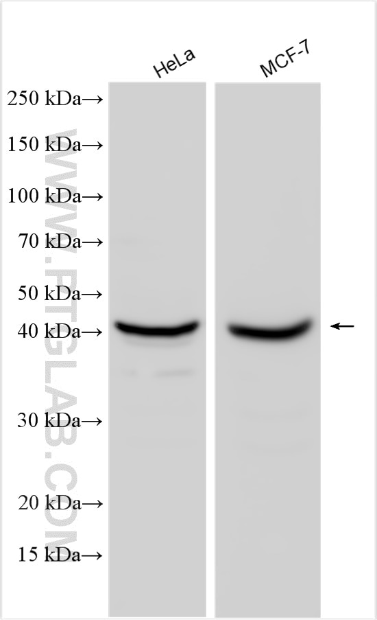 Western Blot (WB) analysis of various lysates using SFRS6 Polyclonal antibody (11772-1-AP)