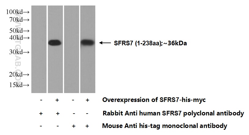 SFRS7 Polyclonal antibody