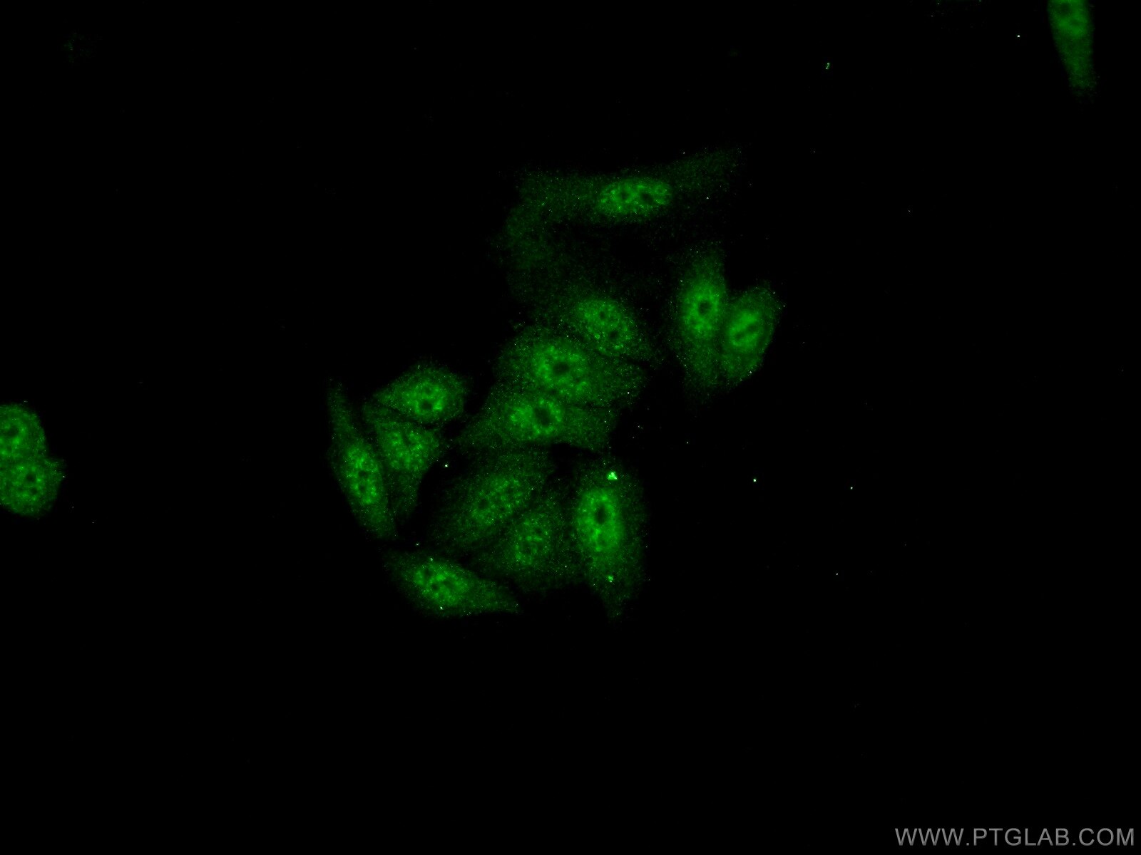 Immunofluorescence (IF) / fluorescent staining of HeLa cells using SFRS8 Polyclonal antibody (24705-1-AP)