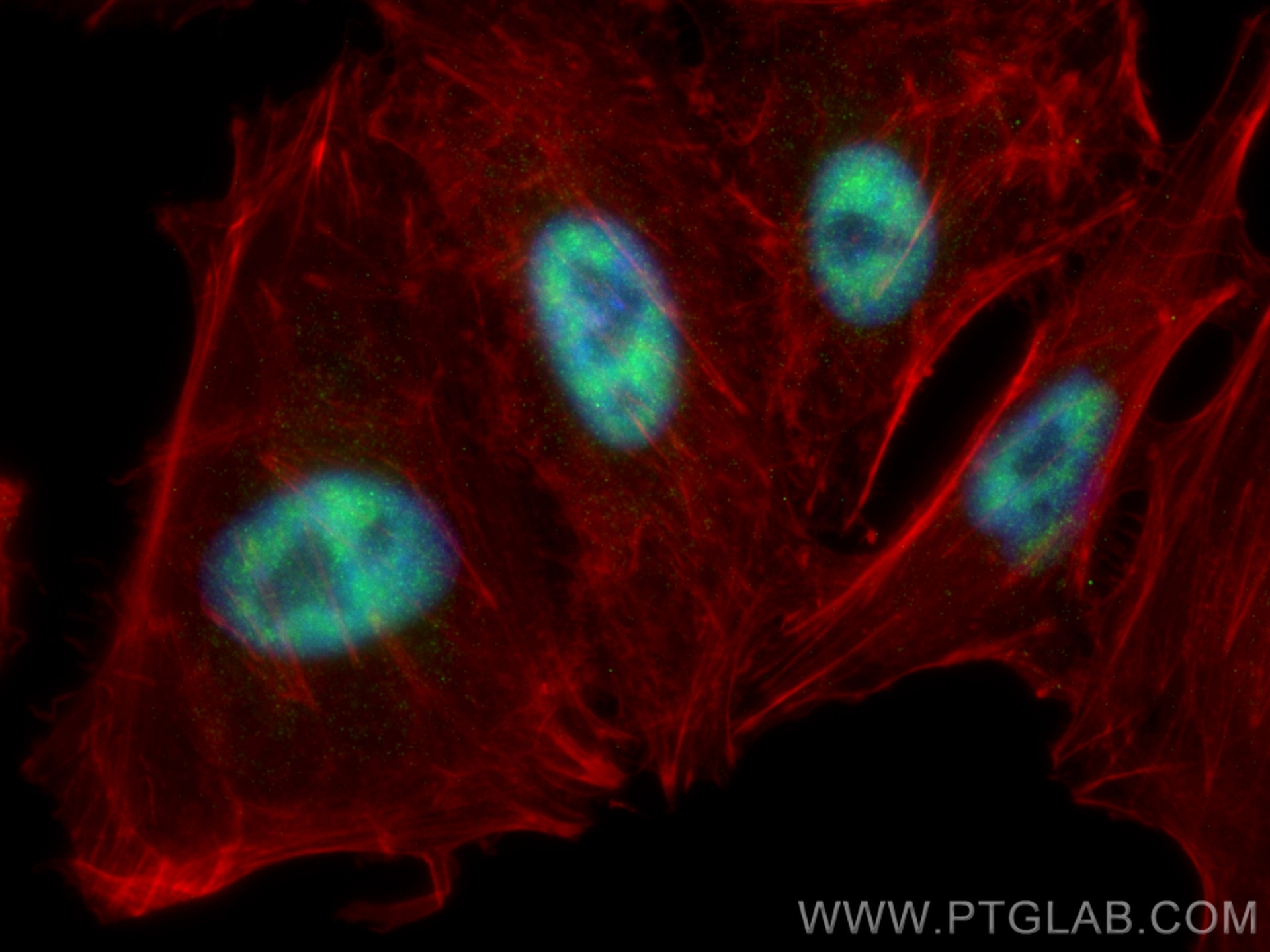 Immunofluorescence (IF) / fluorescent staining of A549 cells using SFRS8 Polyclonal antibody (24705-1-AP)