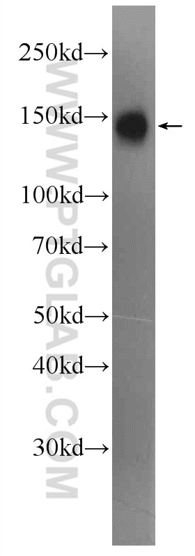 Western Blot (WB) analysis of Jurkat cells using SFRS8 Polyclonal antibody (24705-1-AP)