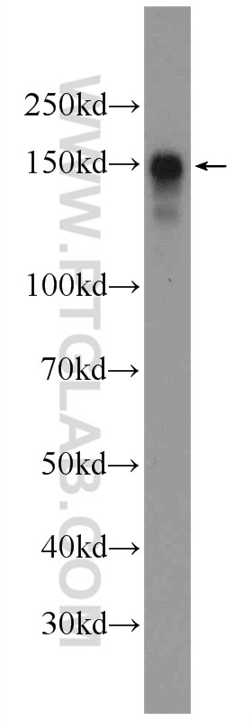 Western Blot (WB) analysis of HeLa cells using SFRS8 Polyclonal antibody (24705-1-AP)