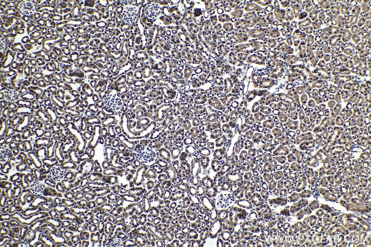 Immunohistochemistry (IHC) staining of mouse kidney tissue using SFRS9 Polyclonal antibody (17926-1-AP)