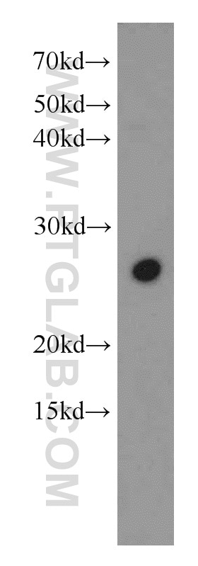 Western Blot (WB) analysis of HEK-293 cells using SFRS9 Polyclonal antibody (17926-1-AP)