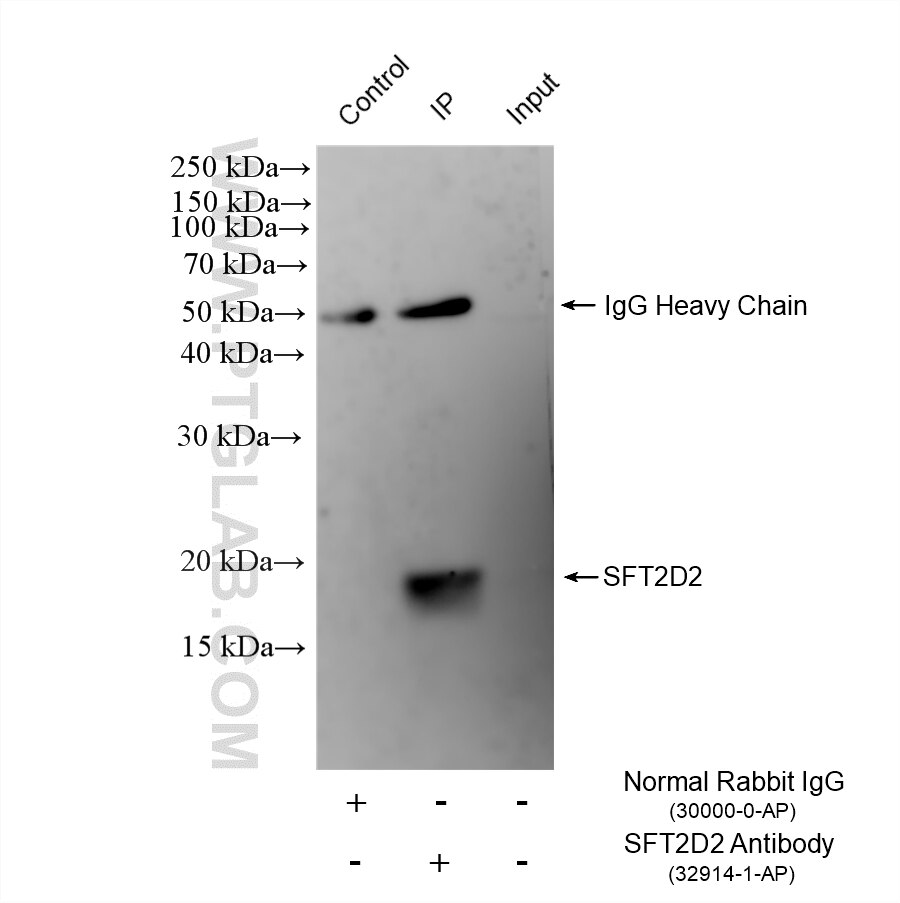 Immunoprecipitation (IP) experiment of HeLa cells using SFT2D2 Polyclonal antibody (32914-1-AP)