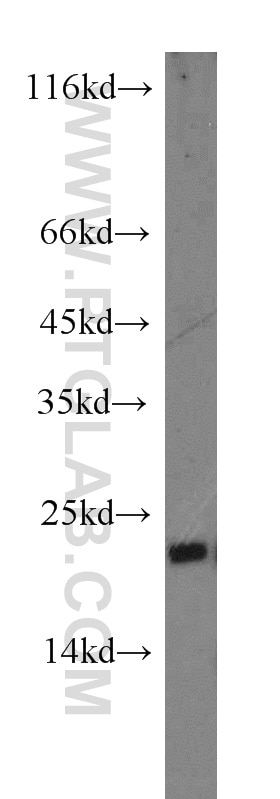 Western Blot (WB) analysis of human liver tissue using SFT2D3 Polyclonal antibody (19758-1-AP)