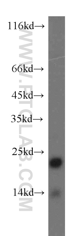 Western Blot (WB) analysis of human liver tissue using SFT2D3 Polyclonal antibody (19758-1-AP)