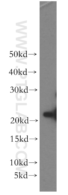 Western Blot (WB) analysis of HeLa cells using SFT2D3 Polyclonal antibody (19758-1-AP)
