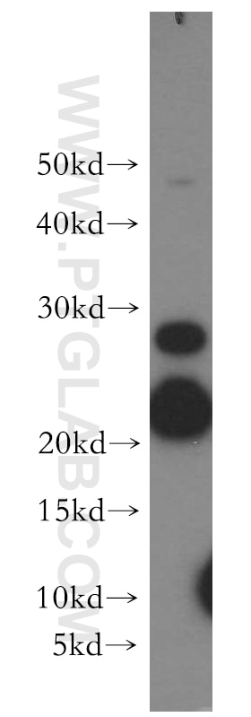 Western Blot (WB) analysis of HeLa cells using SFT2D3 Polyclonal antibody (19758-1-AP)