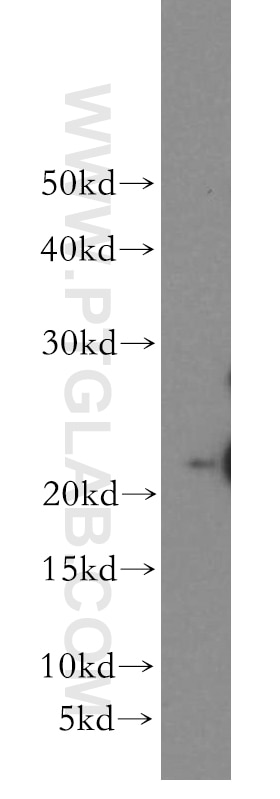 Western Blot (WB) analysis of HepG2 cells using SFT2D3 Polyclonal antibody (19758-1-AP)