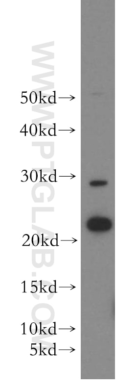 Western Blot (WB) analysis of HepG2 cells using SFT2D3 Polyclonal antibody (19758-1-AP)
