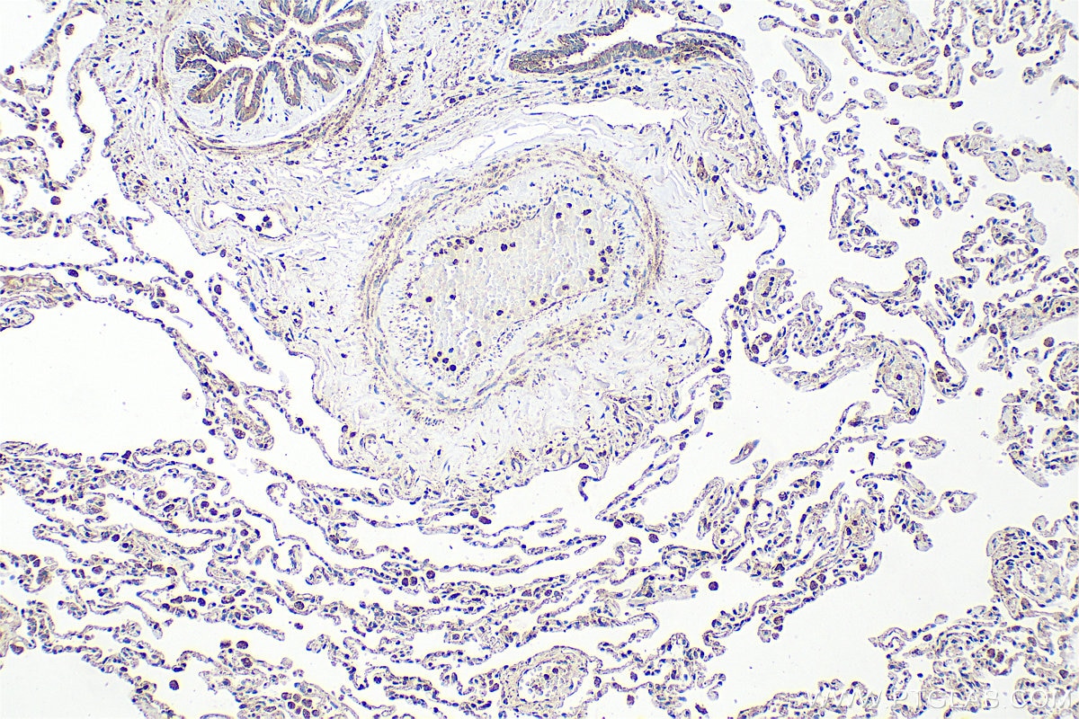 Immunohistochemistry (IHC) staining of human lung tissue using SFTA2 Polyclonal antibody (21145-1-AP)