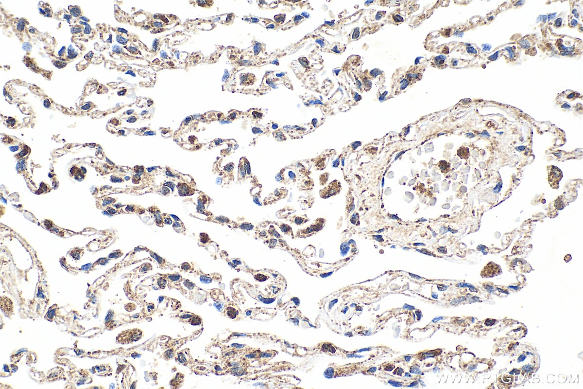 Immunohistochemistry (IHC) staining of human lung tissue using SFTA2 Polyclonal antibody (21145-1-AP)