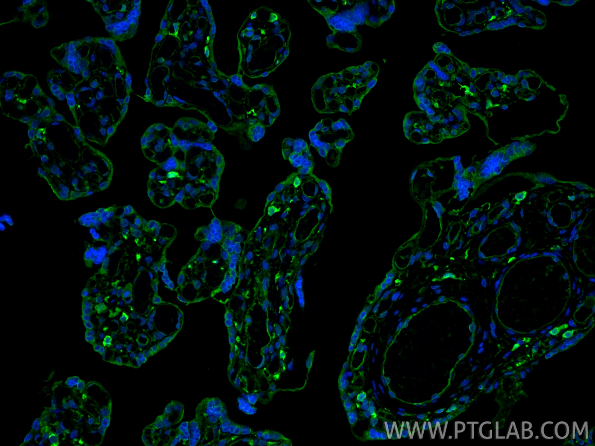 Immunofluorescence (IF) / fluorescent staining of human placenta tissue using Surfactant Protein A Polyclonal antibody (11850-1-AP)