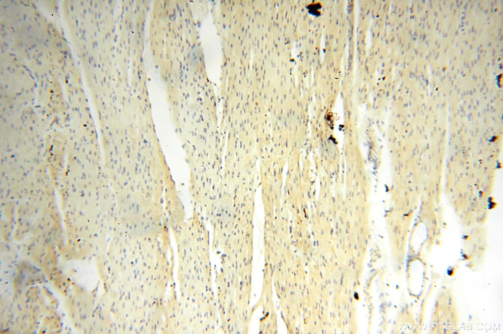 Immunohistochemistry (IHC) staining of human heart tissue using Surfactant Protein A Polyclonal antibody (11850-1-AP)