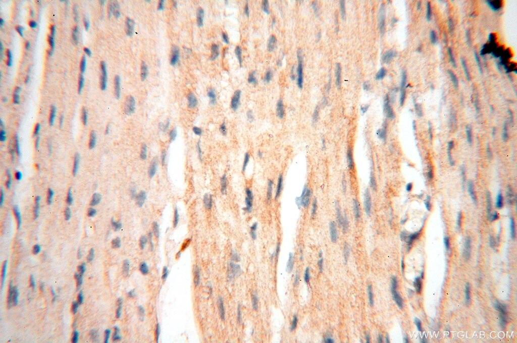 Immunohistochemistry (IHC) staining of human heart tissue using Surfactant Protein A Polyclonal antibody (11850-1-AP)