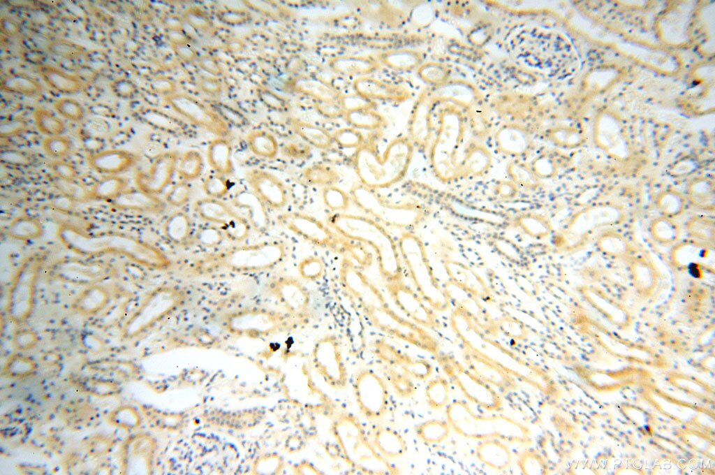 Immunohistochemistry (IHC) staining of human kidney tissue using Surfactant Protein A Polyclonal antibody (11850-1-AP)