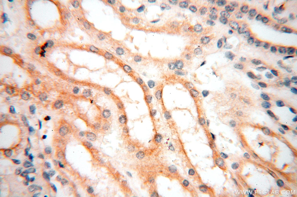 Immunohistochemistry (IHC) staining of human kidney tissue using Surfactant Protein A Polyclonal antibody (11850-1-AP)