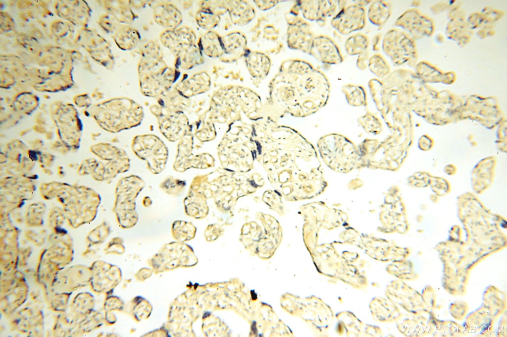 Immunohistochemistry (IHC) staining of human placenta tissue using Surfactant Protein A Polyclonal antibody (11850-1-AP)