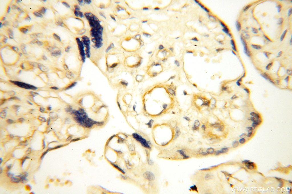 Immunohistochemistry (IHC) staining of human placenta tissue using Surfactant Protein A Polyclonal antibody (11850-1-AP)