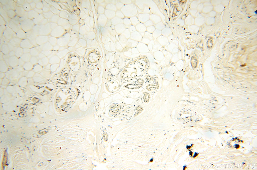 Immunohistochemistry (IHC) staining of human skin tissue using Surfactant Protein A Polyclonal antibody (11850-1-AP)