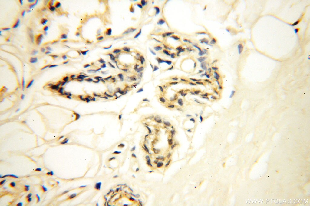 Immunohistochemistry (IHC) staining of human skin tissue using Surfactant Protein A Polyclonal antibody (11850-1-AP)